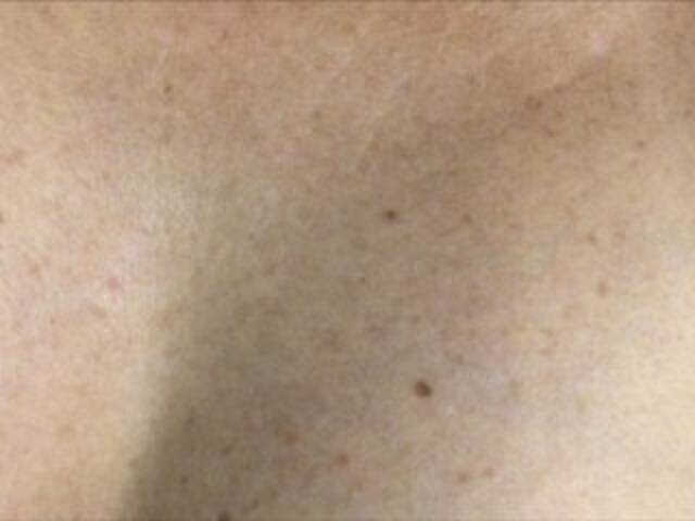 प्रसारण स्क्रीनशॉट Alianakiss