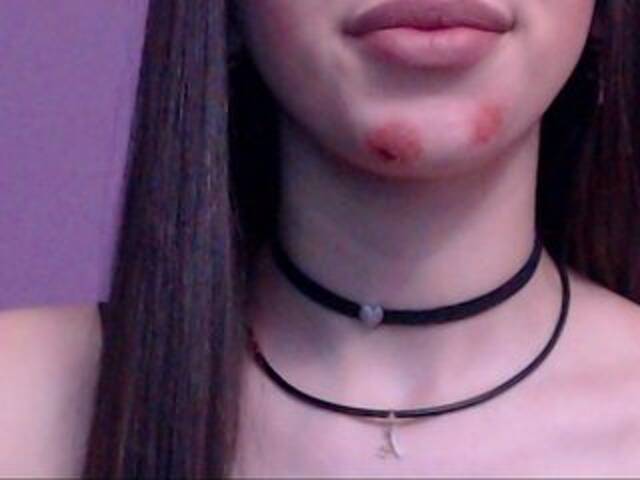 प्रसारण स्क्रीनशॉट Madellyn