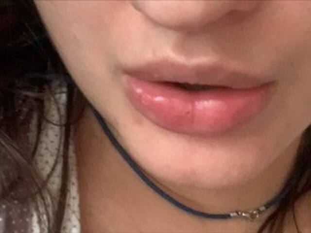 प्रसारण स्क्रीनशॉट Rinaru555555