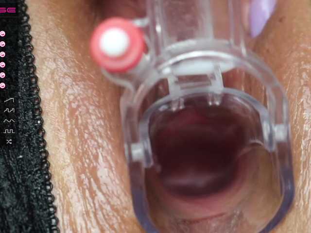 प्रसारण स्क्रीनशॉट StellaFlurry